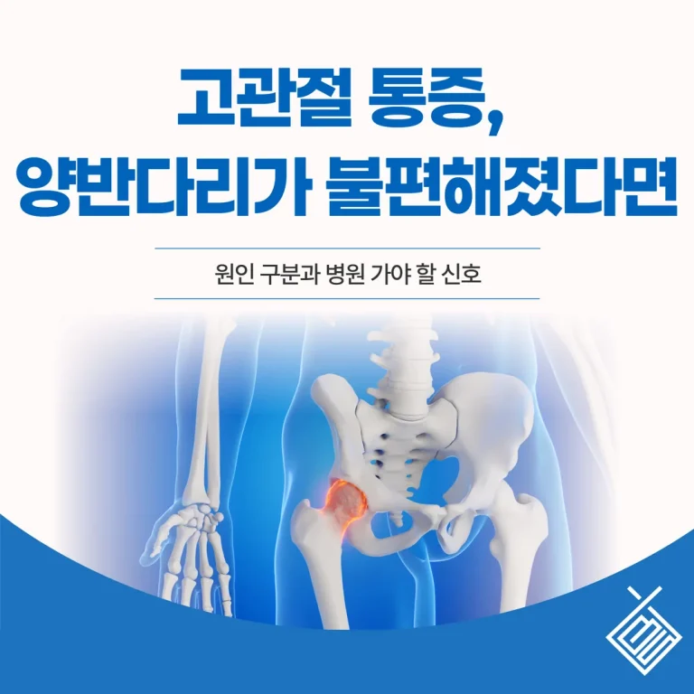 고관절 통증, 양반다리가 불편해졌다면 — 원인 구분과 병원 가야 할 신호