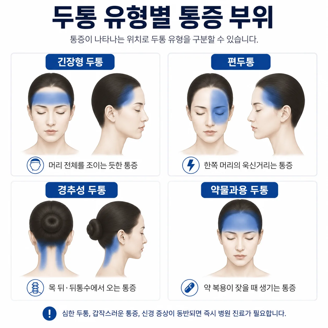 두통 네 가지 유형별 통증 부위 비교 그림