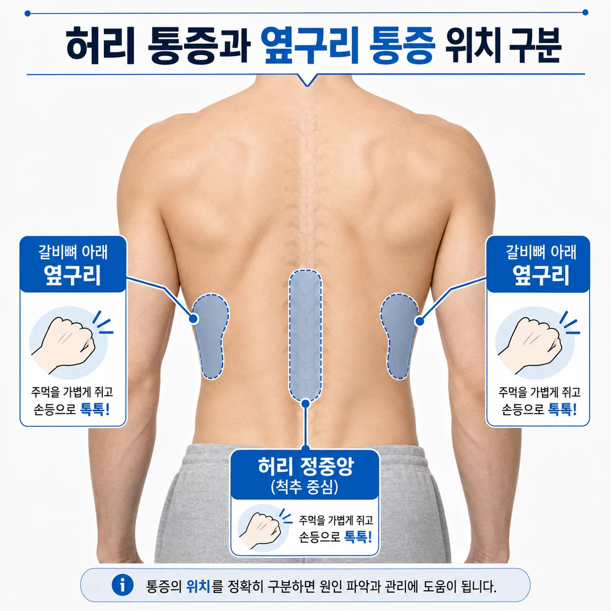 허리 통증과 옆구리 신장 부위 통증을 구분하는 위치