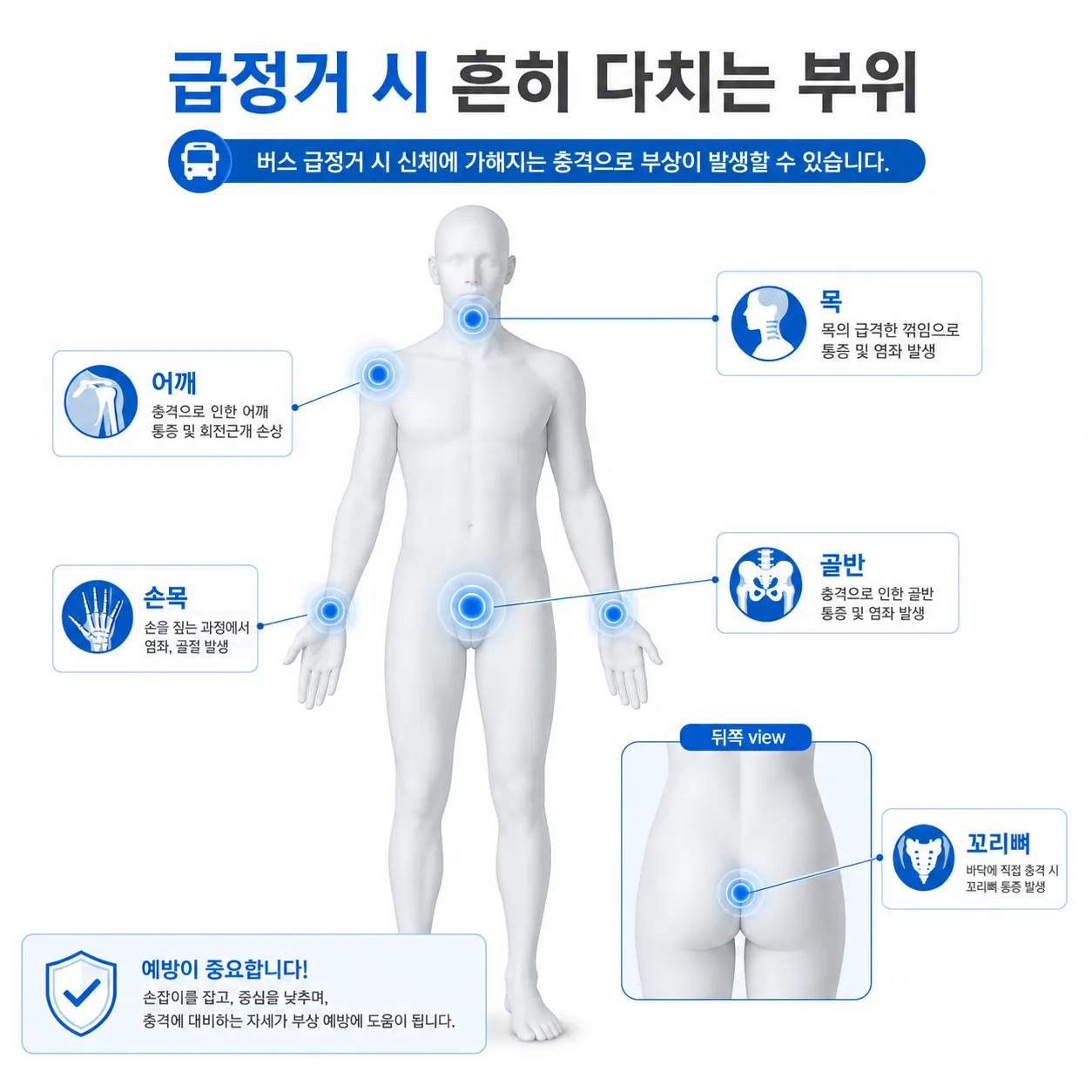 급정거 사고에서 흔히 다치는 신체 부위 지도