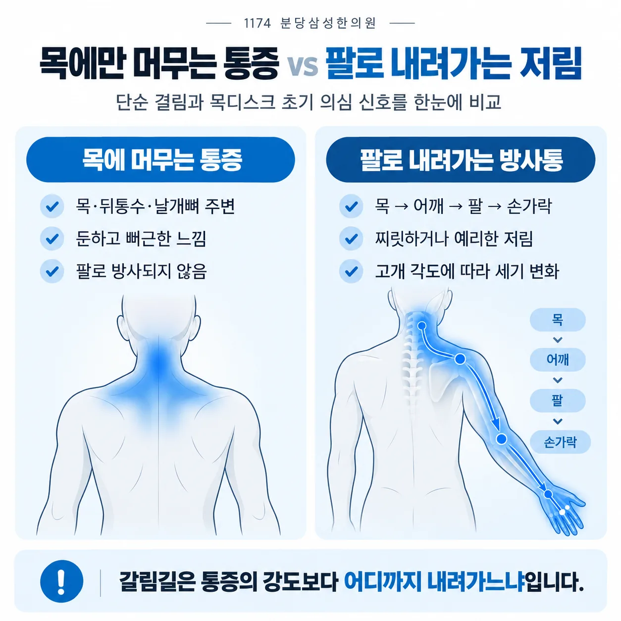 목에 머무는 통증과 팔로 내려가는 방사통의 범위를 비교한 그림